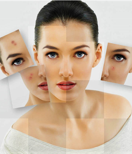 Ayurvedic Skin Treatments